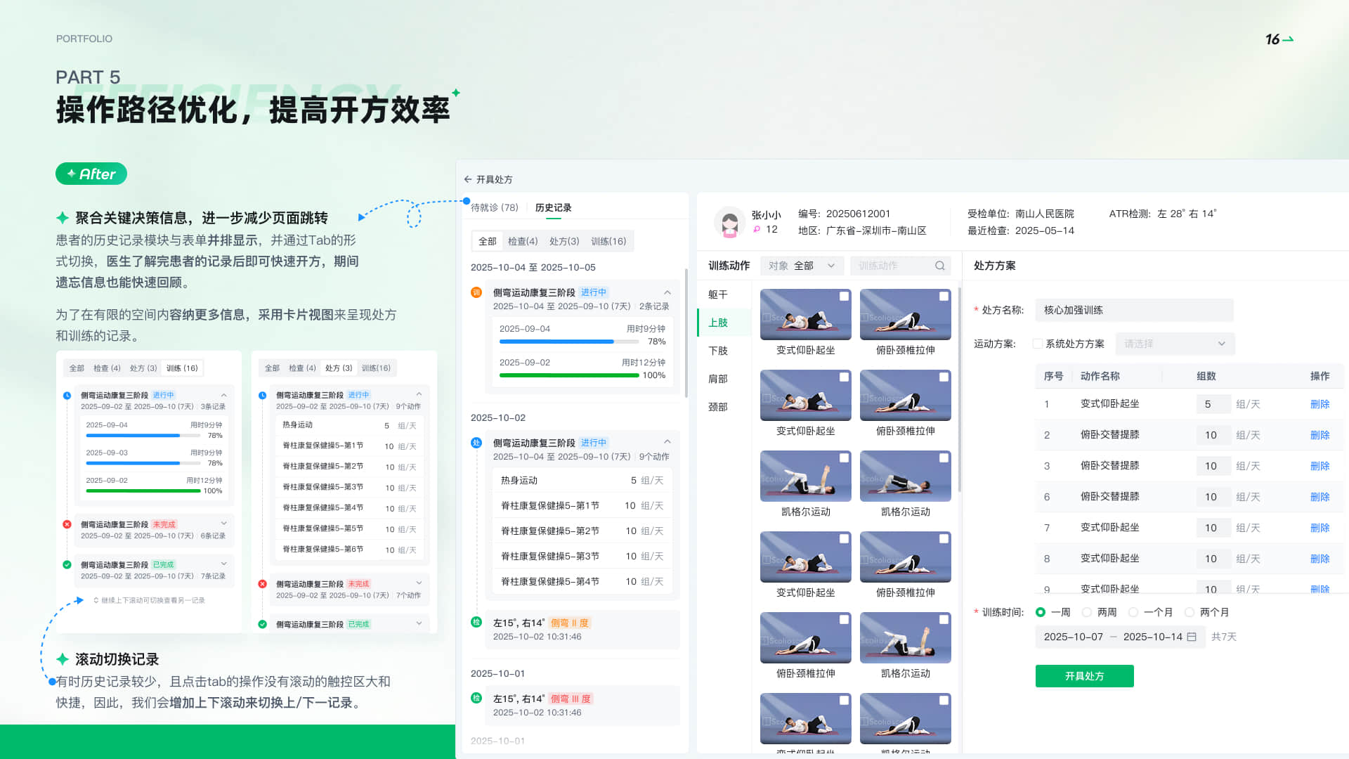 列表和卡片视图切换方案